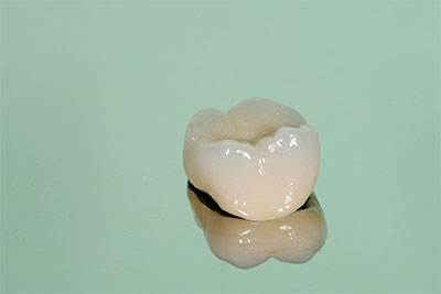 Dental Crowns Ocean Gorve